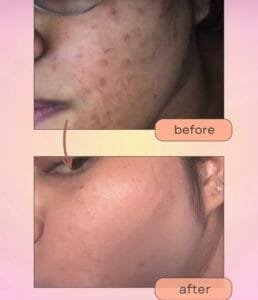 KishKin’s 50mL Organic Rose Hip Rescue Oil