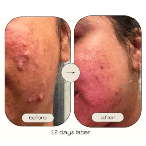 Pure Organic Rose Hip Rescue 50ml Oil for Smooth & Nourished Skin