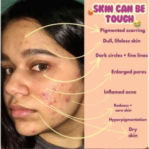 The Best Cold Pressed Rosehip 50ml Oil for Face Glow & Skin Renewal