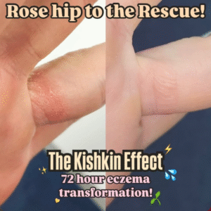 Best Cold Pressed Rosehip 50ml Oil 