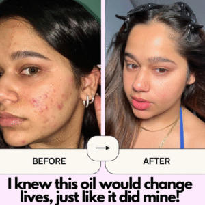 Cold Pressed Rosehip Seed Oil 50mL