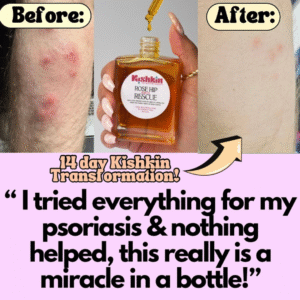 Buy Organic Rose Hip Oil 50mL